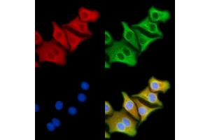 ABIN6257114 and ABIN6274151 staining Hela cells by IF/ICC. (CKM Antikörper  (N-Term))