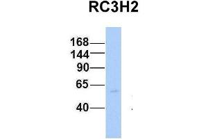 Host:  Rabbit  Target Name:  RC3H2  Sample Type:  Human Fetal Heart  Antibody Dilution:  1. (RC3H2 Antikörper  (Middle Region))