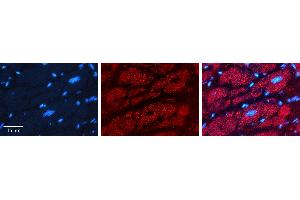 Rabbit Anti-PHB2 Antibody   Formalin Fixed Paraffin Embedded Tissue: Human heart Tissue Observed Staining: Cytoplasmic Primary Antibody Concentration: 1:100 Other Working Concentrations: 1:600 Secondary Antibody: Donkey anti-Rabbit-Cy3 Secondary Antibody Concentration: 1:200 Magnification: 20X Exposure Time: 0. (Prohibitin 2 Antikörper  (N-Term))