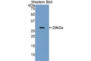 Western blot analysis of recombinant Human ANGPTL2. (ANGPTL2 Antikörper  (AA 267-493))