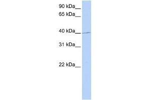 WB Suggested Anti-PAX1 Antibody Titration: 0. (PAX1 Antikörper  (Middle Region))
