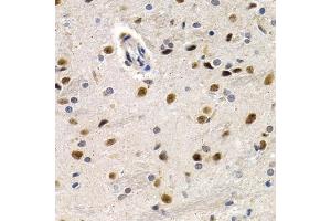 Immunohistochemistry of paraffin-embedded rat brain using ID3 antibody (ABIN6130481, ABIN6142140, ABIN6142141 and ABIN6221020) at dilution of 1:200 (40x lens). (ID3 Antikörper  (AA 1-119))