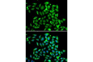 Immunofluorescence analysis of A549 cells using CLASP1 antibody. (CLASP1 Antikörper)