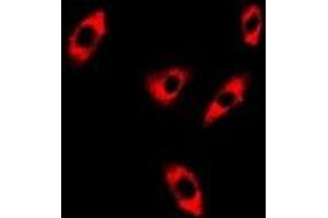 Immunofluorescent analysis of GTL3 staining in A549 cells. (C16orf80 Antikörper)