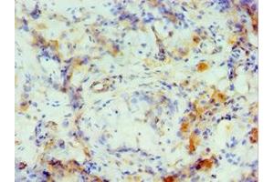 Immunohistochemistry of paraffin-embedded human testis tissue using ABIN7149061 at dilution of 1:100 (CRISP2 Antikörper  (AA 22-243))