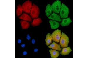 ABIN6263347 and ABIN6277967 staining Hela cells by IF/ICC.