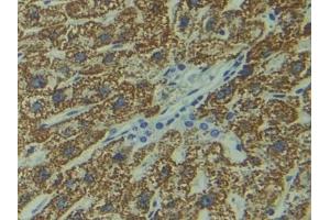 DAB staining on IHC-P; Samples: Human Liver Tissue (DIXDC1 Antikörper  (AA 485-683))