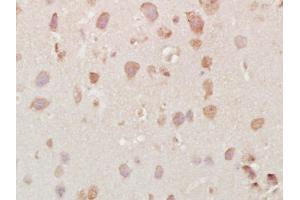 Paraformaldehyde-fixed, paraffin embedded mouse brain, Antigen retrieval by boiling in sodium citrate buffer (pH6) for 15min, Block endogenous peroxidase by 3% hydrogen peroxide for 30 minutes,  Blocking buffer (normal goat serum) at 37°C for 20min, Antibody incubation with Vesicle docking protein p115 Antibody at 1:400 overnight at 4°C, followed by a conjugated secondary and DAB staining. (USO1 Antikörper  (AA 501-600))