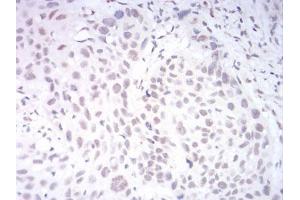 Immunohistochemistry (IHC) image for anti-Lysine (K)-Specific Demethylase 1B (KDM1B) (AA 6-129) antibody (ABIN5542688)