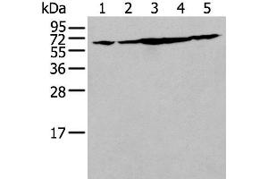 Western blot analysis of NIH/3T3 Hela Jurkat Hepg2 and A549 cell lysates using IRF5 Polyclonal Antibody at dilution of 1:250