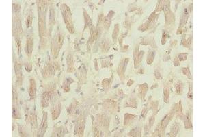 Immunohistochemistry (IHC) image for anti-NADH Dehydrogenase (Ubiquinone) Fe-S Protein 3, 30kDa (NADH-Coenzyme Q Reductase) (NDUFS3) (AA 37-264) antibody (ABIN7160958)