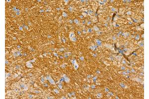 ABIN6266242 and ABIN6277394 at 1/100 staining Rat brain tissue by IHC-P. (Kallikrein 5 Antikörper  (Internal Region))