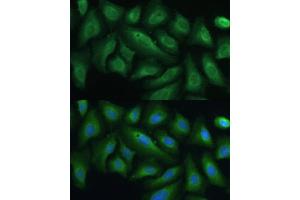 Immunofluorescence analysis of U-2 OS cells using PTPN22 antibody (ABIN3021952, ABIN3021953, ABIN1513449 and ABIN6218285) at dilution of 1:100. (PTPN22 Antikörper  (AA 1-90))