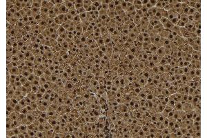 ABIN6278564 at 1/100 staining Rat liver tissue by IHC-P. (TPX2 Antikörper  (C-Term))