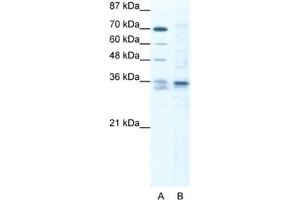 Western Blotting (WB) image for anti-SRY (Sex Determining Region Y)-Box 12 (SOX12) antibody (ABIN2460696) (SOX12 Antikörper)