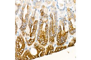Immunohistochemistry of paraffin-embedded Mouse stomach using Cytokeratin 19 (KRT19) antibody (ABIN7268099) at dilution of 1:100 (40x lens). (Cytokeratin 19 Antikörper)