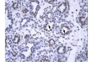 Image no. 1 for anti-YEATS Domain Containing 4 (AA 158-207) antibody (ABIN6735809) (GAS41 Antikörper  (AA 158-207))