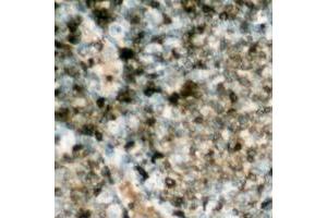Immunohistochemical analysis of HSL (pS552) staining in human lymph node formalin fixed paraffin embedded tissue section. (LIPE Antikörper  (pSer552))