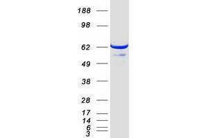 Western Blotting (WB) image for General Transcription Factor IIF, Polypeptide 1, 74kDa (GTF2F1) protein (Myc-DYKDDDDK Tag) (ABIN2722316)