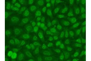Immunofluorescence analysis of A549 cell using TSEN2 antibody. (TSEN2 Antikörper)