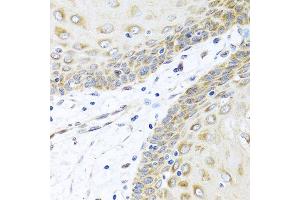Immunohistochemistry of paraffin-embedded human esophagus using INHBC antibody at dilution of 1:100 (40x lens).