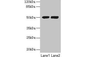 Western blot All lanes: TUBA3E antibody at 3 μg/mL Lane 1: MCF-7 whole cell lysate Lane 2: Hela whole cell lysate Secondary Goat polyclonal to rabbit IgG at 1/10000 dilution Predicted band size: 50 kDa Observed band size: 50 kDa (TUBA3E Antikörper  (AA 1-250))