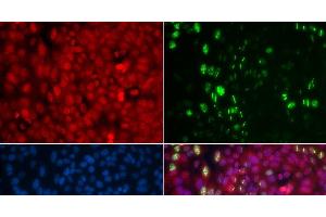 Immunofluorescence analysis of U2OS cells using Phospho-ABL1(Y204) Polyclonal Antibody (ABL1 Antikörper  (pTyr204))