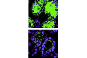 Immunohistochemical staining. (IL-18 Antikörper)