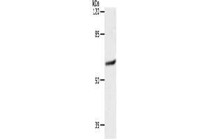 Western Blotting (WB) image for anti-Solute Carrier Family 16 (Monocarboxylic Acid Transporters), Member 4 (SLC16A4) antibody (ABIN2426191) (SLC16A4 Antikörper)