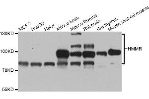 Western blot analysis of extracts of various cell lines, using HMMR antibody. (HMMR Antikörper  (AA 341-440))