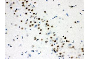Immunohistochemistry (IHC) image for anti-Wingless-Type MMTV Integration Site Family, Member 2B (WNT2B) (AA 87-112), (N-Term) antibody (ABIN3042337)