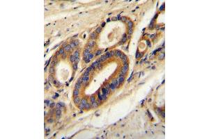 Immunohistochemistry (Paraffin-embedded Sections) (IHC (p)) image for anti-ATPase, H+ Transporting, Lysosomal 21kDa, V0 Subunit B (ATP6V0B) (AA 104-131) antibody (ABIN654391)
