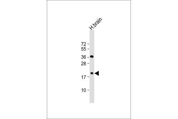 beta Synuclein Antikörper  (C-Term)