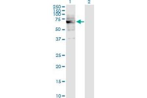 Western Blot analysis of DKC1 expression in transfected 293T cell line by DKC1 monoclonal antibody (M04), clone 3E10.