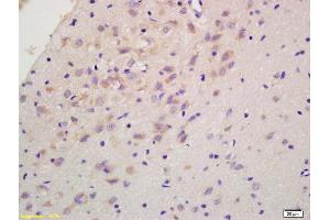 Formalin-fixed and paraffin embedded rat brain labeled with Anti-RGS2 Polyclonal Antibody, Unconjugated (ABIN669291) at 1:200 followed by conjugation to the secondary antibody and DAB staining. (RGS2 Antikörper  (AA 116-211))