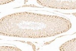 Immunohistochemistry analysis of paraffin-embedded mouse testis using,ZCCHC7 (ABIN7076279) at dilution of 1: 3000 (ZCCHC7 Antikörper)