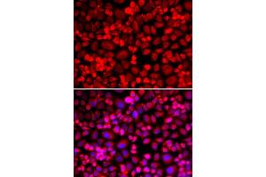 Immunofluorescence analysis of HeLa cell using ANLN antibody. (Anillin Antikörper)