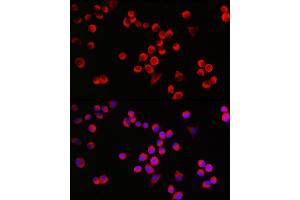 Immunofluorescence analysis of Neuro-2a cells using G Rabbit pAb (ABIN6127469, ABIN6140954, ABIN6140955 and ABIN6221997) at dilution of 1:25 (40x lens). (GAP43 Antikörper  (AA 1-238))