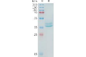 SDS-PAGE (SDS) image for ADAM Metallopeptidase Domain 17 (ADAM17) (AA 581-642) protein (Fc Tag) (ABIN6964407)