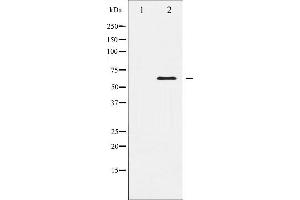 Western blot analysis of Elk1 expression in HeLa whole cell lysates,The lane on the left is treated with the antigen-specific peptide. (ELK1 Antikörper  (C-Term))