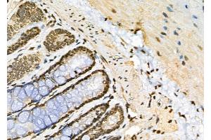 ABIN6257379 and ABIN6273550 at 1/100 staining Rat colorectal tissue by IHC-P.