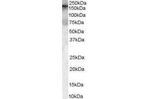 Western Blotting (WB) image for rho Guanine Nucleotide Exchange Factor (GEF) 5 (ARHGEF5) peptide (ABIN368874) (rho Guanine Nucleotide Exchange Factor (GEF) 5 (ARHGEF5) Peptid)