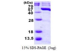 SDS-PAGE (SDS) image for Mitogen-Activated Protein Kinase 11 (MAPK11) (AA 1-364) protein (His tag) (ABIN7529190) (MAPK11 Protein (AA 1-364) (His tag))