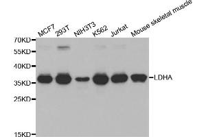 Western blot analysis of extracts of various cell lines, using LDHA antibody (ABIN5970494) at 1/1000 dilution. (Lactate Dehydrogenase A Antikörper)