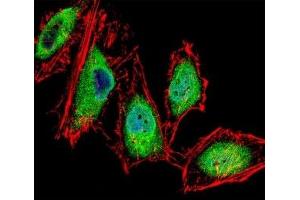 Immunofluorescence (IF) image for anti-Runt-Related Transcription Factor 3 (RUNX3) (AA 168-197) antibody (ABIN3032505)