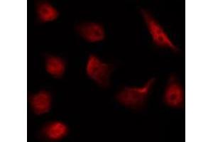 ABIN6267592 staining NIH-3T3 by IF/ICC. (MEK1 Antikörper  (pThr292))