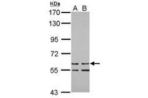 Image no. 1 for anti-Zinc Finger Protein 419 (ZNF419) (AA 1-151) antibody (ABIN1501844) (ZNF419 Antikörper  (AA 1-151))