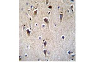 Imunohistochemistry analysis in formalin fixed and paraffin embedded human brain tissue using CRFR2D Antibody  followed by peroxidase conjugation of the secondary antibody and DAB staining. (CRHR2 Antikörper)