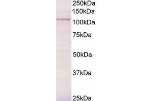 Western Blotting (WB) image for Breast Cancer Anti-Estrogen Resistance 3 (BCAR3) peptide (ABIN369781) (Breast Cancer Anti-Estrogen Resistance 3 (BCAR3) Peptid)