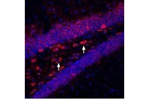 Expression of Kir6. (Potassium Inwardly-Rectifying Channel, Subfamily J, Member 11 (KCNJ11) Peptid)